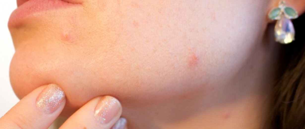 Was tun gegen starken Haarwuchs im Gesicht? Was tun gegen starken Haarwuchs im Gesicht?